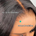 Natural Hairline